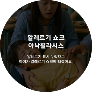 알레르기